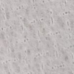 ベンリーゼマスク拡大画像